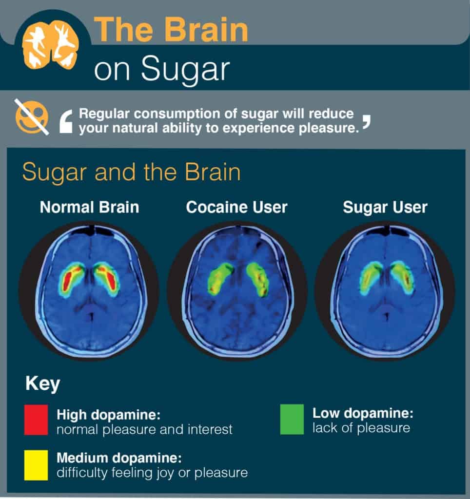 The brain on sugar